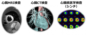 MRI